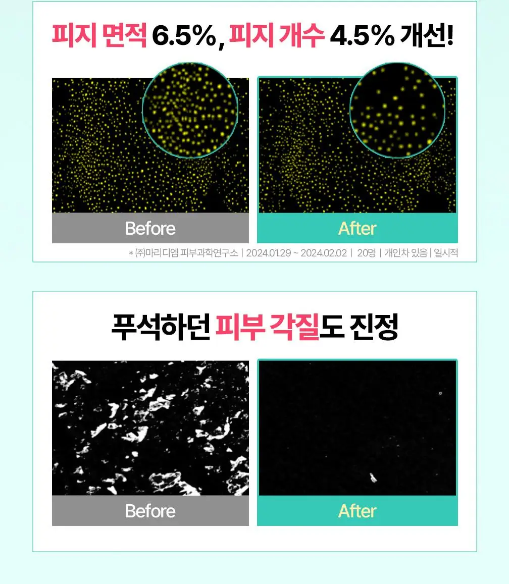 [온라인단독/진정SET] 브링그린 티트리 시카 수딩 토너&크림 (세트/기획) 상세페이지 21